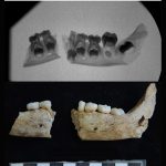 Antropología Dental